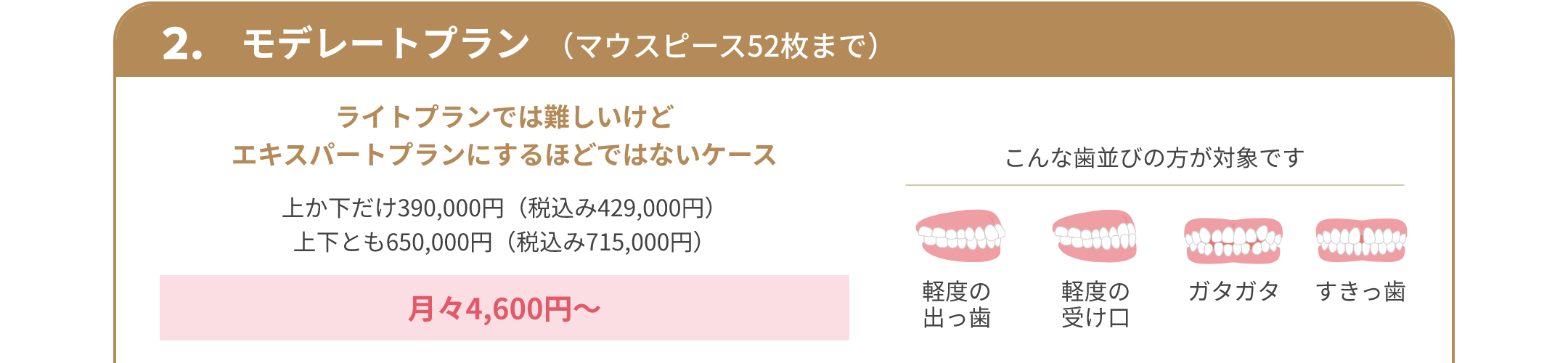 2.モデレートプラン （マウスピース52枚まで） ライトプランでは難しいけどエキスパートプランにするほどではないケース 上か下だけ390,000円（税込み429,000円） 上下とも650,000円（税込み715,000円） 月々4,600円～ こんな歯並びの方が対象です 軽度の出っ歯 軽度の受け口 ガタガタ すきっ歯