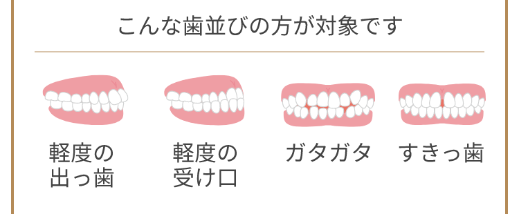 こんな歯並びの方が対象です 軽度の出っ歯 軽度の受け口 ガタガタ すきっ歯