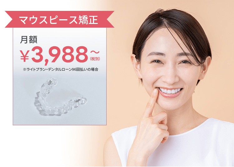マウスピース矯正 月額¥3,988(税別)〜 ※ライトプラン・デンタルローン96回払いの場合